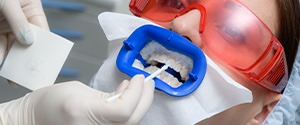 Speak to Dr. Michitti about options for making teeth whitening more affordable