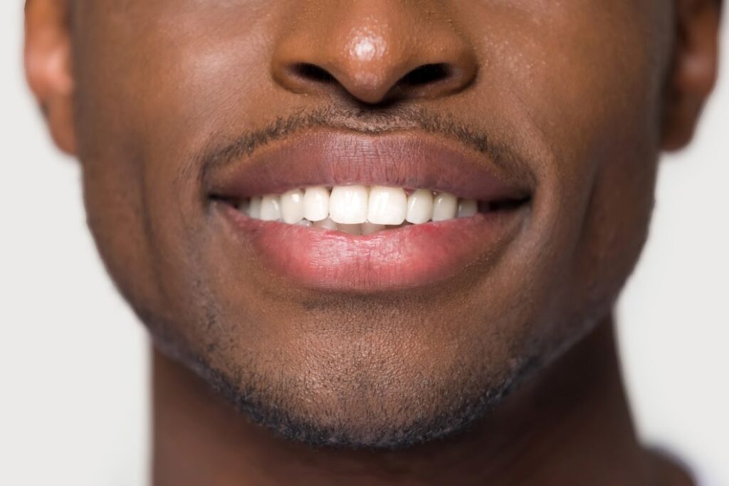 A man with veneers.